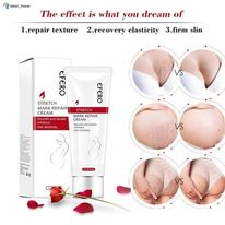 Stretch Mark Removal Cream